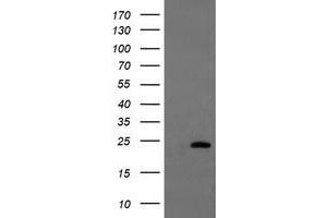 HEK293T cells were transfected with the pCMV6-ENTRY control (Left lane) or pCMV6-ENTRY UBE2E3 (Right lane) cDNA for 48 hrs and lysed. (UBE2E3 antibody)