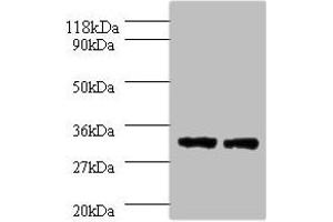 Western blot All lanes: HLA-DPA1 antibody at 2 μg/mL Lane 1: 293T whole cell lysate Lane 2: HepG2 whole cell lysate Secondary Goat polyclonal to rabbit IgG at 1/10000 dilution Predicted band size: 30 kDa Observed band size: 30 kDa (HLA-DPA1 antibody  (AA 29-222))