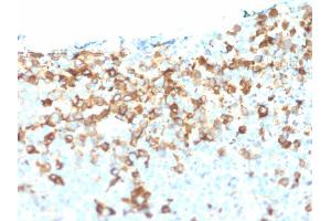 Immunohistochemistry (IHC) image for anti-Nerve Growth Factor Receptor (NGFR) (AA 281-421) antibody (ABIN6940196)