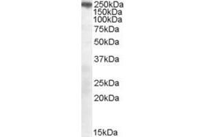 Western Blotting (WB) image for anti-Sortilin-Related Receptor, L(DLR Class) A Repeats Containing (SORL1) (AA 2203-2214) antibody (ABIN297696) (SORL1 antibody  (AA 2203-2214))
