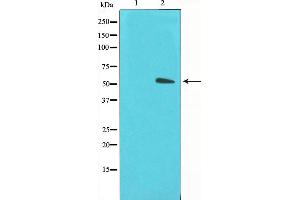 Western blot analysis on LOVO cell lysate using GLUT3 Antibody,The lane on the left is treated with the antigen-specific peptide. (SLC2A3 antibody  (C-Term))