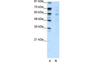 WB Suggested Anti-CBFA2T3 Antibody Titration:  2. (CBFA2T3 antibody  (N-Term))