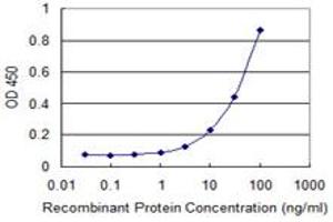 Detection limit for recombinant GST tagged ZKSCAN1 is 1 ng/ml as a capture antibody. (ZKSCAN1 antibody  (AA 1-563))