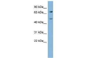 WB Suggested Anti-GFPT2 Antibody Titration:  0. (GFPT2 antibody  (Middle Region))