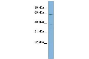 WB Suggested Anti-CYP4F3 Antibody Titration:  0. (CYP4F3 antibody  (N-Term))