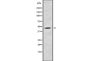 Western blot analysis of CHST14 using HepG2 whole cell lysates (CHST14 antibody  (Internal Region))