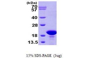 SDS-PAGE (SDS) image for Prefoldin Subunit 2 (PFDN2) (AA 1-154) protein (His tag) (ABIN667258) (PFDN2 Protein (AA 1-154) (His tag))