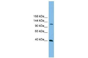 MAP3K14 antibody used at 1 ug/ml to detect target protein. (MAP3K14 antibody  (N-Term))
