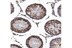 IHC analysis of DAZL using anti-DAZL antibody (ABIN7601384).