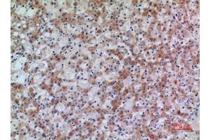 Immunohistochemistry (IHC) analysis of paraffin-embedded Human Liver, antibody was diluted at 1:100. (17beta-HSD4 (N-Term) antibody)
