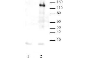 LexA DNA-binding Domain pAb tested by Western blot. (LexA (DNA Binding Domain) antibody)