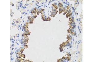 Immunohistochemistry of paraffin-embedded Mouse lung using B9D1 Polyclonal Antibody at dilution of 1:100 (40x lens). (B9D1 antibody)