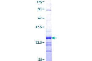 IMMP2L Protein (AA 31-102) (GST tag)