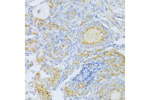 Immunohistochemistry (Paraffin-embedded Sections) (IHC (p)) image for anti-Cytochrome C, Somatic (CYCS) (AA 1-105) antibody (ABIN6139304)