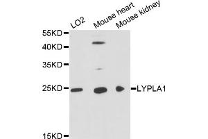 Western blot analysis of extracts of various cell lines, using LYPLA1 antibody (ABIN1873576) at 1:3000 dilution. (LYPLA1 antibody)