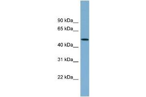 Human 721_B; WB Suggested Anti-ACTR3B Antibody Titration: 0.