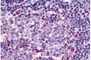 Human Tonsil (formalin-fixed, paraffin-embedded) stained with SARM1 antibody ABIN213875 at 2 ug/ml followed by biotinylated goat anti-rabbit IgG secondary antibody ABIN481713, alkaline phosphatase-streptavidin and chromogen. (SARM1 antibody  (C-Term))
