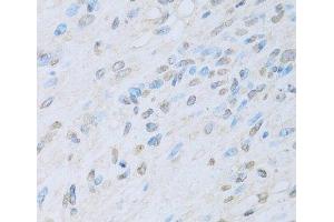 Immunohistochemistry (Paraffin-embedded Sections) (IHC (p)) image for anti-K(lysine) Acetyltransferase 2A (KAT2A) antibody (ABIN7260323)