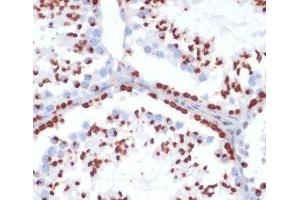 Immunohistochemistry of paraffin-embedded Mouse testis using Phospho-γH2A. (gamma H2AX antibody  (pSer139))