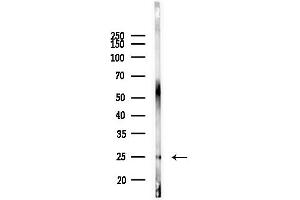 anti-Lysophospholipase I (LYPLA1) (Internal Region) antibody
