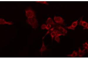 ABIN6274234 staining RAW264. (TNFSF8 antibody  (Internal Region))