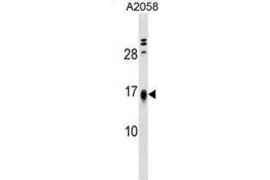 Western Blotting (WB) image for anti-Limb-Bud and Heart (LBH) antibody (ABIN5019448)