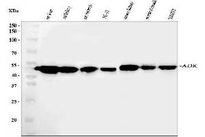 Western blot analysis of ADK using anti-ADK antibody (ABIN4886430). (ADK antibody  (AA 165-351))