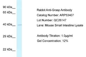 Western Blotting (WB) image for anti-GRP1 (General Receptor For phosphoinositides 1)-Associated Scaffold Protein (GRASP) (N-Term) antibody (ABIN2785380)