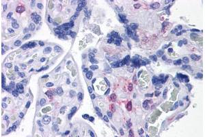 Human Placenta: Formalin-Fixed, Paraffin-Embedded (FFPE) (PLAC1 antibody  (C-Term))