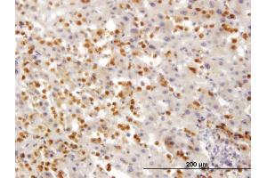 Immunoperoxidase of monoclonal antibody to TARS on formalin-fixed paraffin-embedded human liver. (TARS antibody  (AA 44-143))