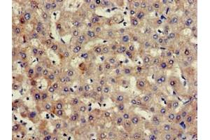 Immunohistochemistry of paraffin-embedded human liver tissue using ABIN7154998 at dilution of 1:100 (Hemopexin antibody  (AA 32-254))