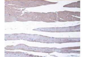 IHC-P analysis of Mouse Skeletal Muscle Tissue, with DAB staining. (CBR1 antibody  (AA 66-271))