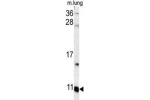 Western Blotting (WB) image for anti-S100 Calcium Binding Protein A6 (S100A6) antibody (ABIN3003159) (S100A6 antibody)