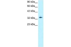 WB Suggested Anti-NR2F6 Antibody   Titration: 0. (NR2F6 antibody  (N-Term))