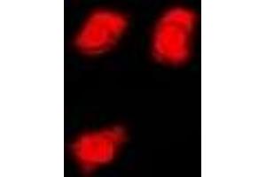 Immunofluorescent analysis of FMR1 staining in U2OS cells. (FMR1 antibody)