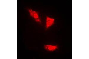 Immunofluorescent analysis of p53 (pS15) staining in PC12 cells. (p53 antibody  (N-Term, pSer15))