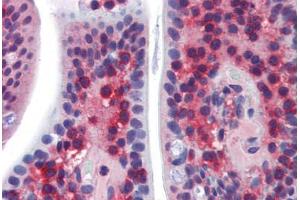 Human Small Intestine (formalin-fixed, paraffin-embedded) stained with SSX2IP antibody ABIN462255 followed by biotinylated goat anti-rabbit IgG secondary antibody ABIN481713, alkaline phosphatase-streptavidin and chromogen. (SSX2IP antibody  (AA 362-411))