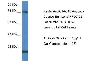 Western Blotting (WB) image for anti-Cancer/testis Antigen 1B (CTAG1B) (C-Term) antibody (ABIN786263) (CTAG1B antibody  (C-Term))