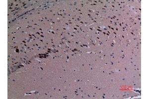 Immunohistochemistry (IHC) analysis of paraffin-embedded Mouse Brain, antibody was diluted at 1:100. (SND1 antibody  (Internal Region))