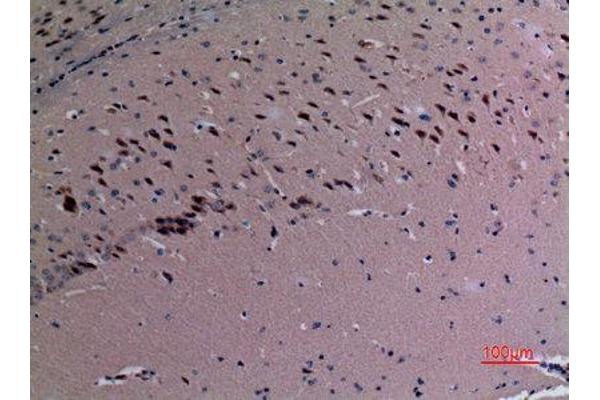 SND1 antibody  (Internal Region)