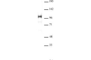 SATB1 antibody (pAb) tested by Western blot. (SATB1 antibody  (N-Term))