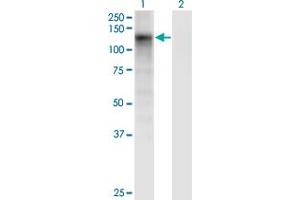 Western Blot analysis of DSE expression in transfected 293T cell line by DSE monoclonal antibody (M03), clone 6D4.