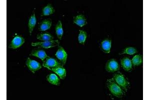 Immunofluorescent analysis of A549 cells using ABIN7174662 at dilution of 1:100 and Alexa Fluor 488-congugated AffiniPure Goat Anti-Rabbit IgG(H+L) (UAP1 antibody  (AA 1-522))