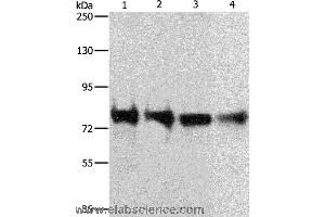 Western blot analysis of 293T, hela, Jurkat and Lovo cell, using CDH6 Polyclonal Antibody at dilution of 1:300 (CDH6 antibody)