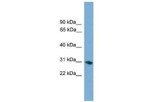 FCN1 antibody used at 0. (FCN1 antibody  (Middle Region))