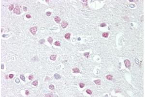 Anti-MC5 Receptor antibody IHC staining of human brain, cortex. (MC5 Receptor antibody  (AA 24-35))