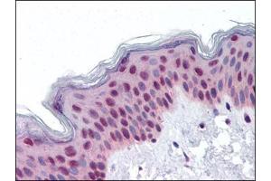 Human Skin: Formalin-Fixed, Paraffin-Embedded (FFPE) (RUVBL2 antibody  (Ser129))