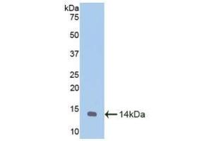 Detection of Recombinant MTNR1A, Caprine using Polyclonal Antibody to Melatonin Receptor 1A (MTNR1A) (Melatonin Receptor 1A antibody  (AA 312-366))