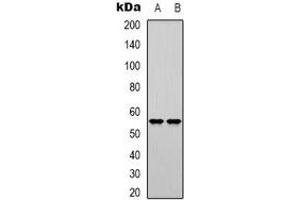 Western blot analysis of DNA Polymerase mu expression in K562 (A), Jurkat (B) whole cell lysates. (POLM antibody)