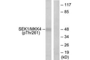 Western blot analysis of extracts from 293 cells treated with UV 15', using SEK1/MKK4 (Phospho-Thr261) Antibody. (MAP2K4 antibody  (pThr261))